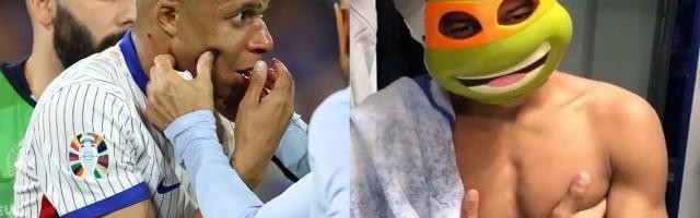 开云网页登录-【盘点】断鼻姆巴佩将解锁新皮肤，细数足坛“面具侠”